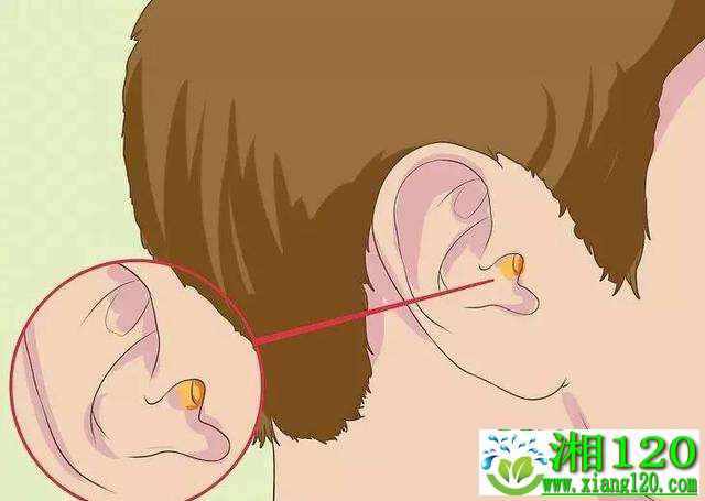 外耳道炎症状有哪些 怎么治 耳鼻喉 湘1健康网