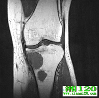 Сϸ���ΰ���ת����ô��