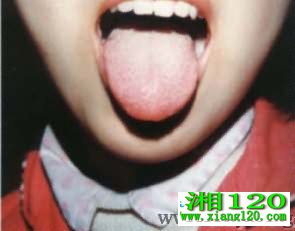 ��������������̦