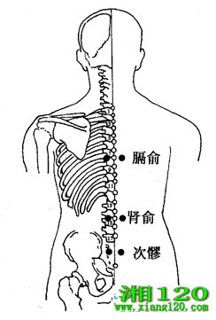 ͼ3-8-1ᡢᡢs