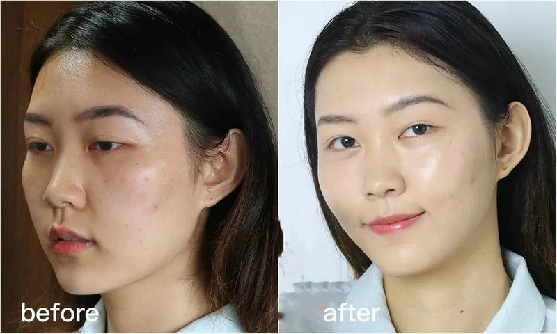 治疗失眠的方法是什么 治疗失眠的方法是什么