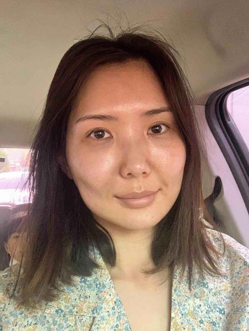 腮腺炎能吃什么食物 腮腺炎能吃什么食物