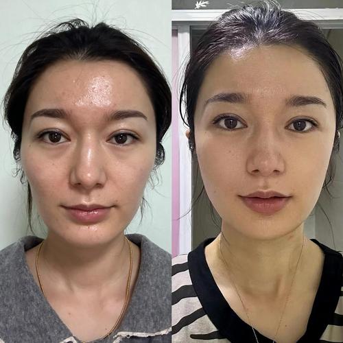 莲子心泡水喝的五大功效 莲子心泡水喝的五大功效