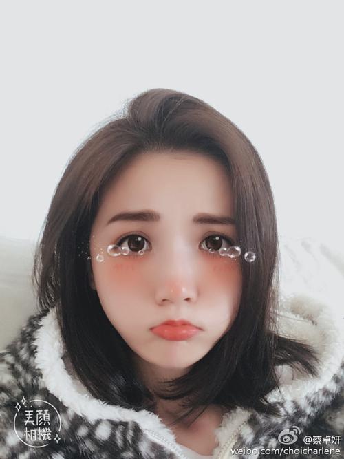 懒汉病能治好吗 如何才能预防懒汉病 懒汉病能治好吗 如何才能预防懒汉病