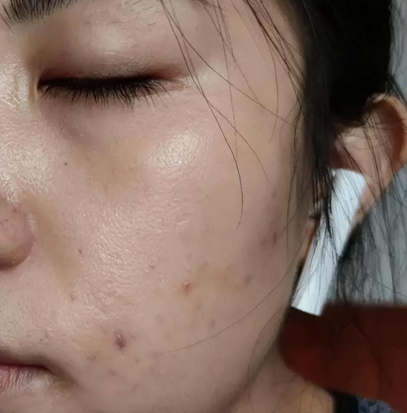 护手霜可以擦脸吗 专家建议最好不要 护手霜可以擦脸吗 专家建议最好不要