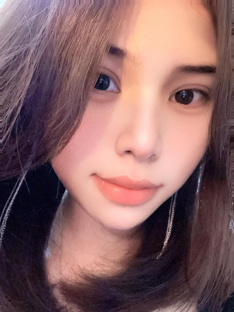 头疼怎么办 教你十招快速止头疼秘籍 头疼怎么办 教你十招快速止头疼秘籍