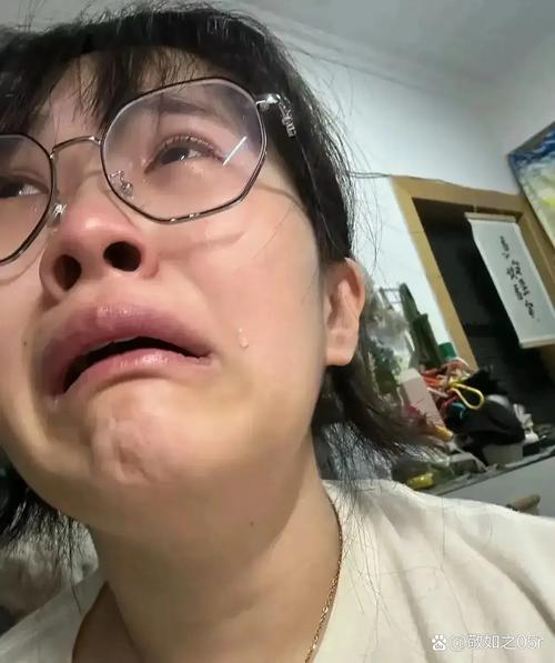 脂溢性脱发类型有哪些 脂溢性脱发分类介绍 脂溢性脱发类型有哪些 脂溢性脱发分类介绍