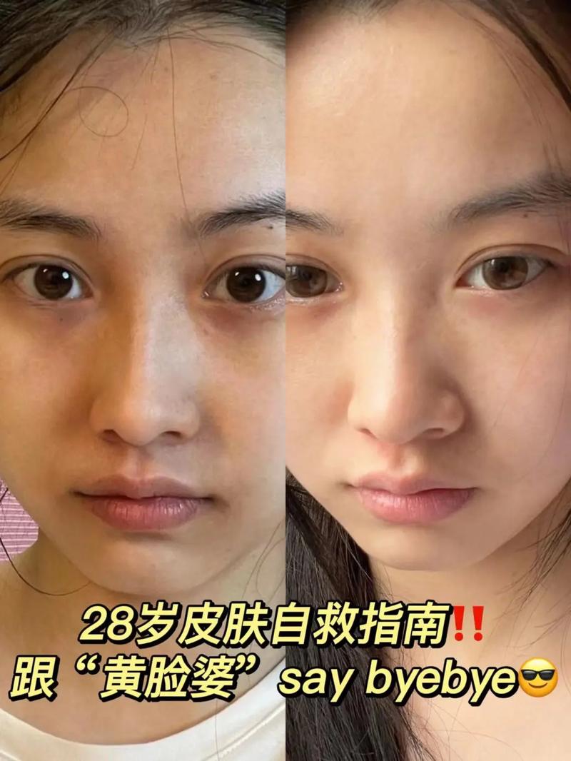 长期低烧不退 使用冰敷方法时应该注意的问题 长期低烧不退 使用冰敷方法时应该注意的问题