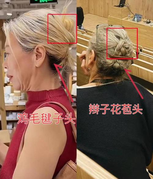 做完太阳穴填充感冒怎么办 做完太阳穴填充感冒怎么办