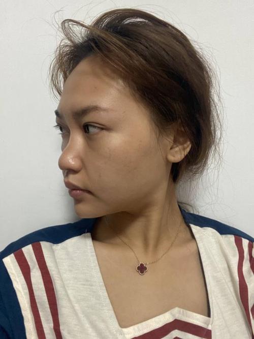 口臭有哪些分类 分享口臭分类大全 口臭有哪些分类 分享口臭分类大全