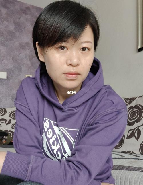 无名指发麻使不上力怎么办 无名指发麻使不上力怎么办