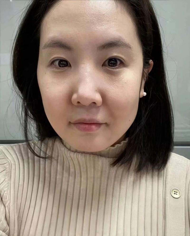 做骨盆修复有效果吗 做骨盆修复有效果吗