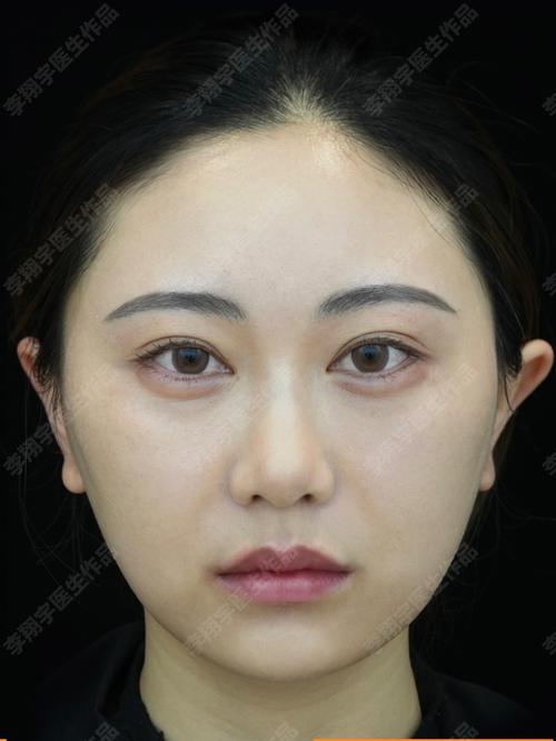 ɳԷ�ӺͶ�����ˮ�ȵĹ�Ч������ ɳԷ�ӺͶ�����ˮ�ȵ�5����Ч