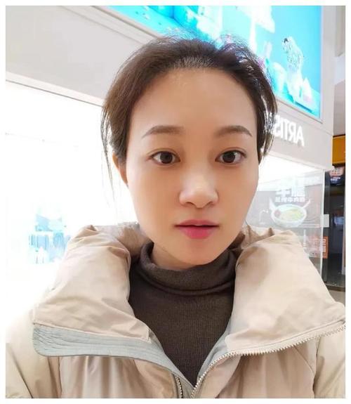 胃泌素17偏低是什么意思 胃泌素17偏低是什么意思