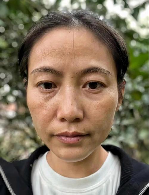 ��֢ʧ��֢״����Щ ʧ�ߵ�3�����