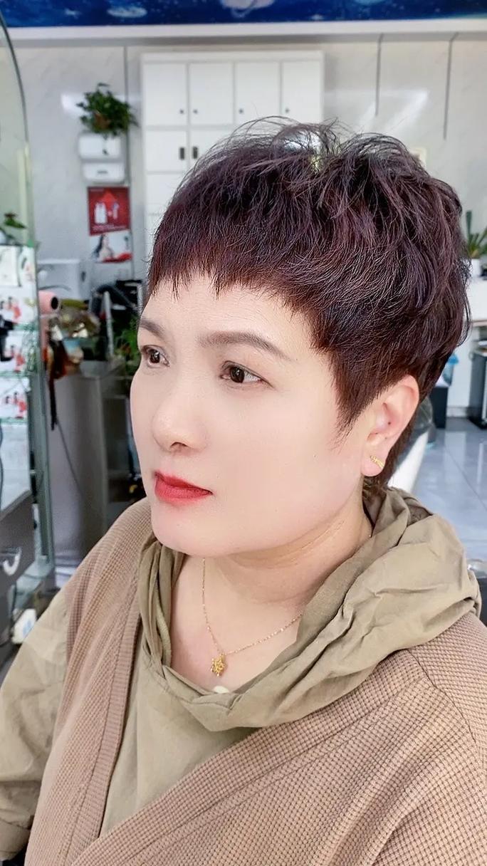 中度地中海贫血需要治疗吗 中度地中海贫血需要治疗吗