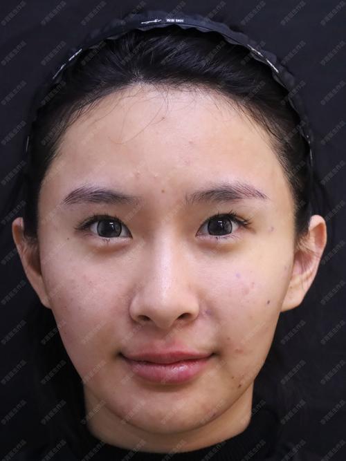 ��֫����Ӳ����������