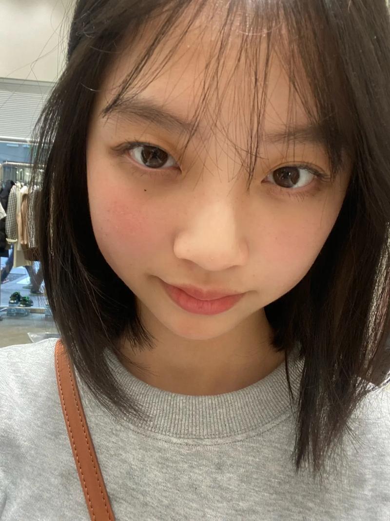 降脂药需要长期吃吗 高血脂的病因和表现 降脂药需要长期吃吗 高血脂的病因和表现