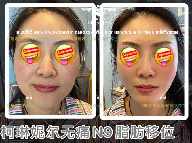 激素六项孕酮低 激素六项孕酮低