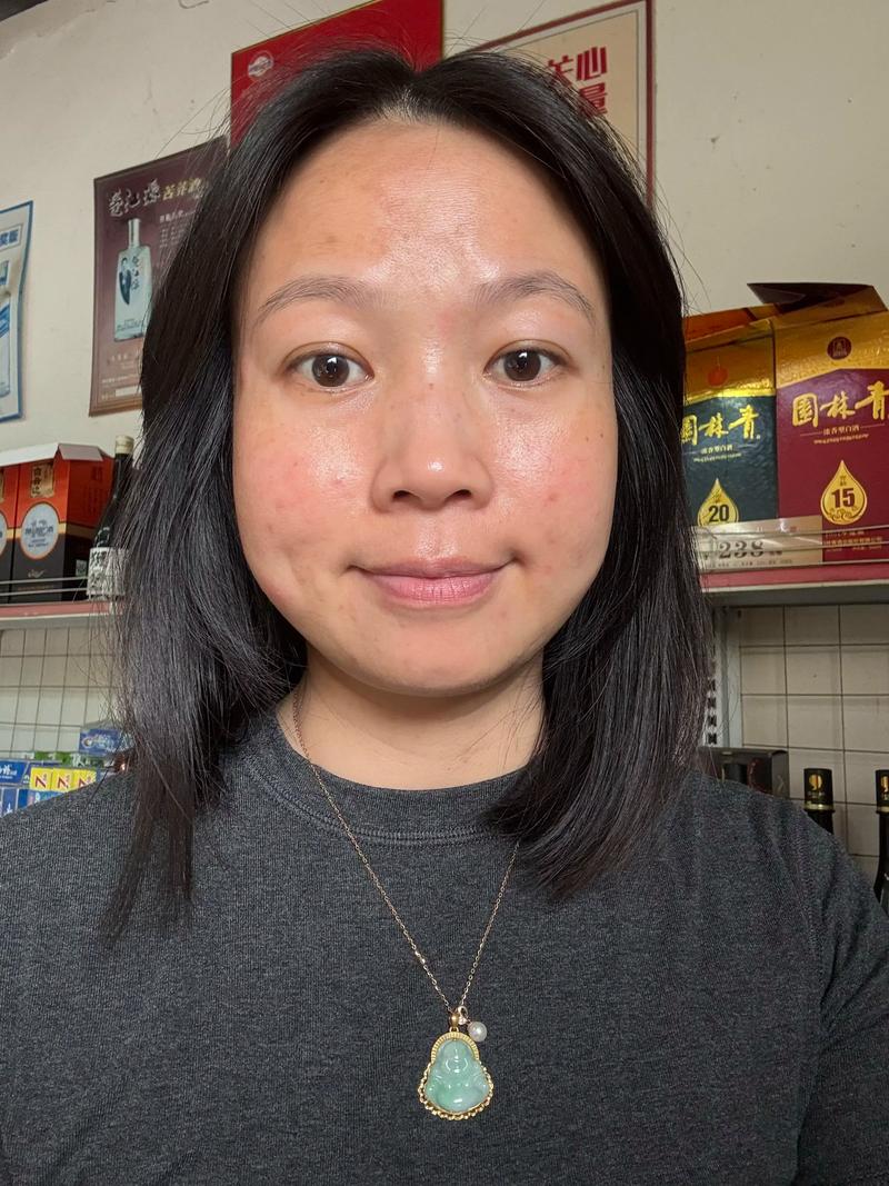 什么是支原体感染 支原体感染那些事 什么是支原体感染 支原体感染那些事