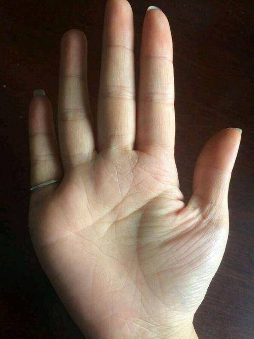 大蒜油的禁忌 服用大蒜油有什么禁忌 大蒜油的禁忌 服用大蒜油有什么禁忌