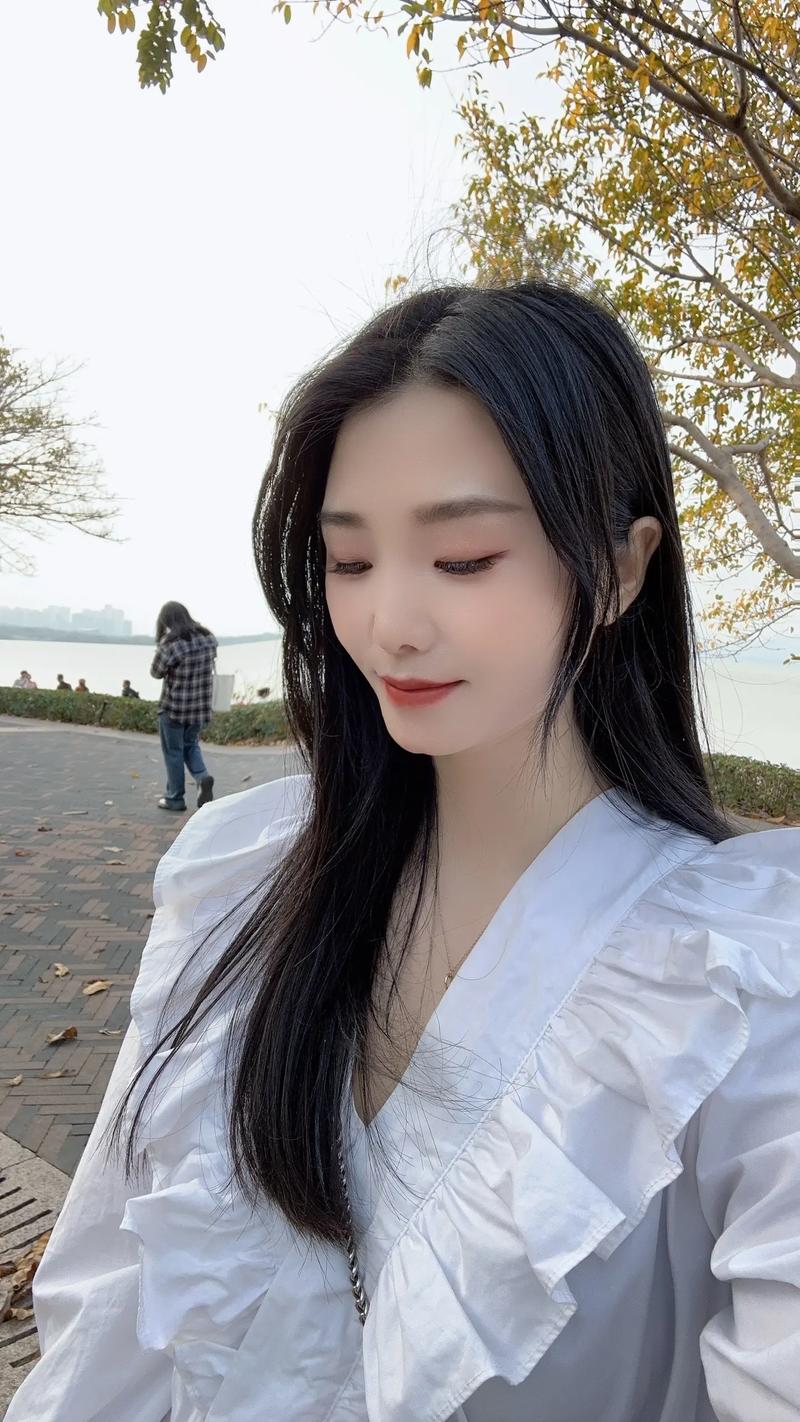 左侧睾丸鞘膜腔积液 左侧睾丸鞘膜腔积液