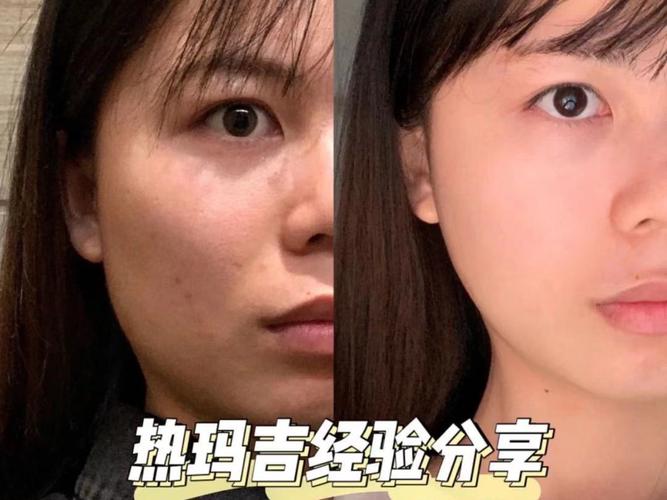 肝炎全套检查包括什么 肝炎全套检查包括什么