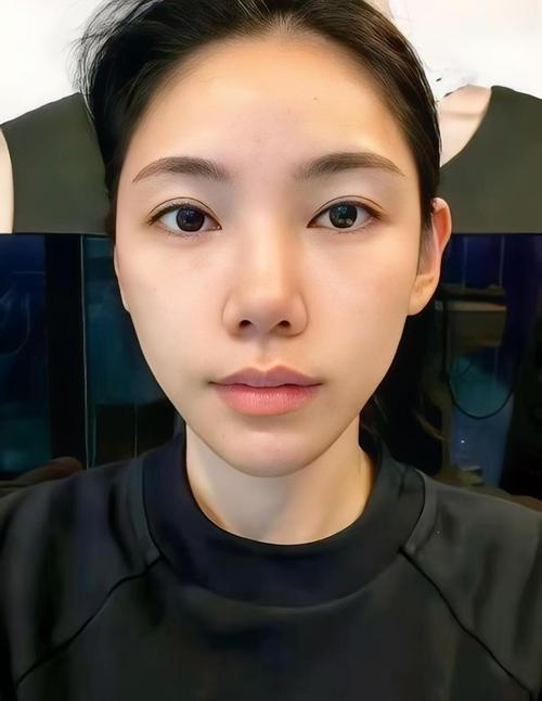 脑萎缩能活多久 :应个人病症而定 脑萎缩能活多久 :应个人病症而定