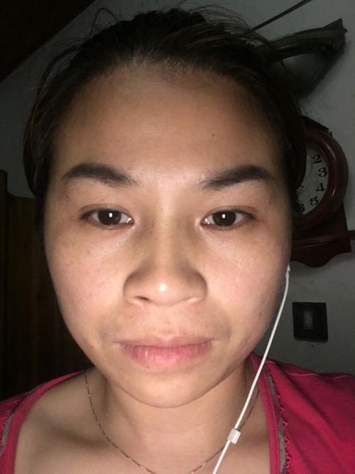 颈椎病饮食注意什么  曝光颈椎病饮食疗法小妙招 颈椎病饮食注意什么  曝光颈椎病饮食疗法小妙招