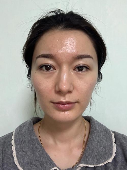 祛斑与淡斑你真的分的清楚吗 祛斑与淡斑你真的分的清楚吗