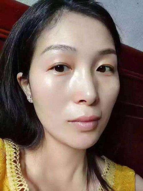 孕妇吃虾过敏了怎么办 给你治过敏的小建议 孕妇吃虾过敏了怎么办 给你治过敏的小建议