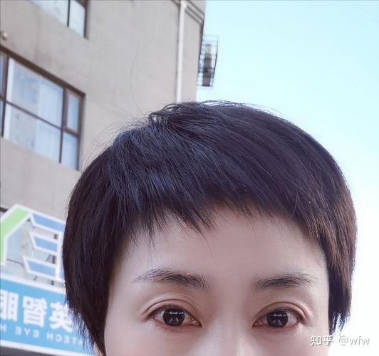 眼睛老花怎样才能恢复正常 眼睛老花怎样才能恢复正常