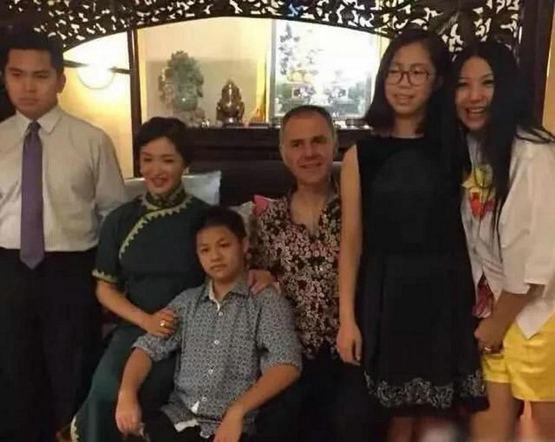 什么治疗脱发有效 专家介绍6种方法 什么治疗脱发有效 专家介绍6种方法