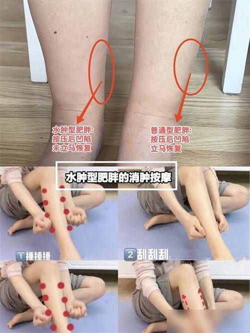 引起肛瘘发作的病因有哪些 五种原因易发肛瘘 引起肛瘘发作的病因有哪些 五种原因易发肛瘘