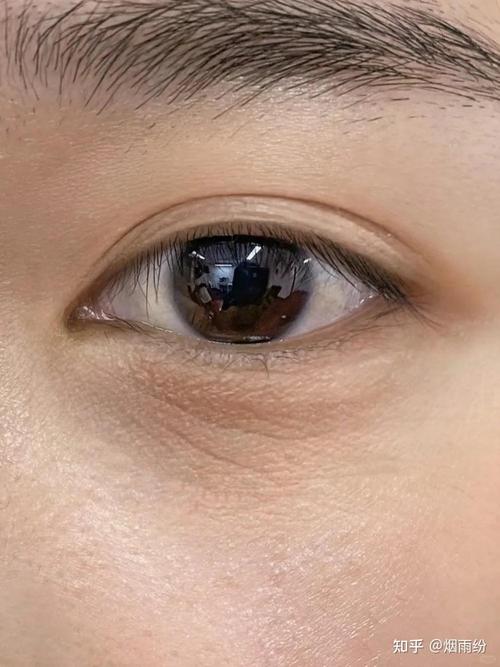 Ѫ�Ǹߺ�ʲô��� ��Ǯ���轵Ѫ�Ǻܹ���