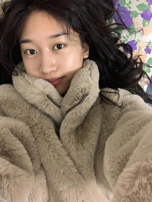 脂溢性皮炎头皮疼什么原因 脂溢性皮炎头皮疼什么原因