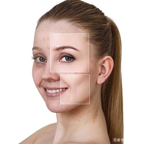 ���Ƥ��ˮ����ô�� ����������õ���