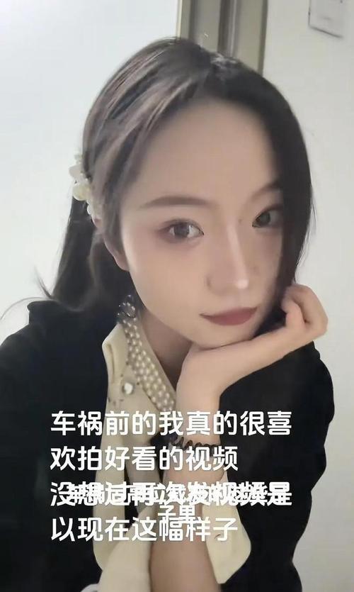 脂肪填充一年多了脸部显胖 脂肪填充一年多了脸部显胖