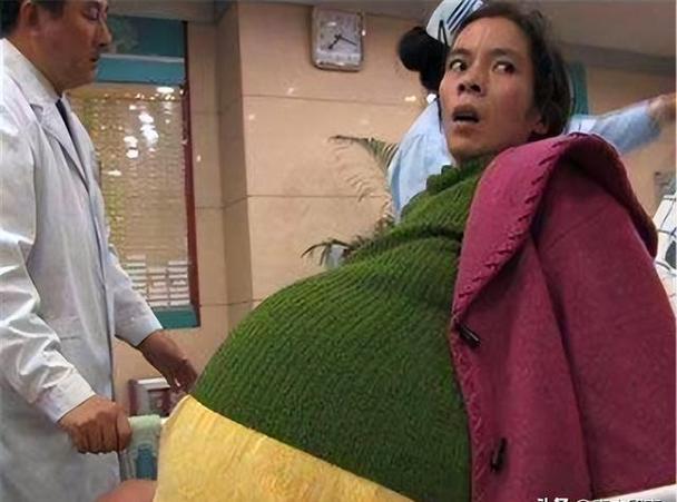 掉头发缺少什么营养 掉头发缺少什么营养