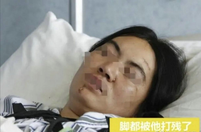 深海鱼油对类风湿性关节炎、脊椎性关节炎、支气管哮喘和糖尿病的 深海鱼油对类风湿性关节炎、脊椎性关节炎、支气管哮喘和糖尿病的