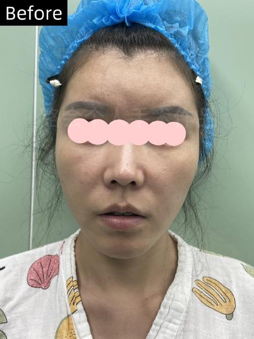 怎么降低龟头灵敏度的三种方法 怎么降低龟头灵敏度的三种方法