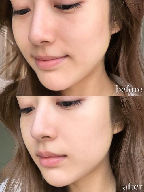 抗肿瘤药都有哪些毒性 抗肿瘤药都有哪些毒性