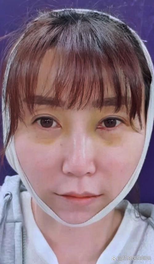 ΪʲôҪ���ֻ���ҩ������Ӧ�� ������ҩ��3����Խ��