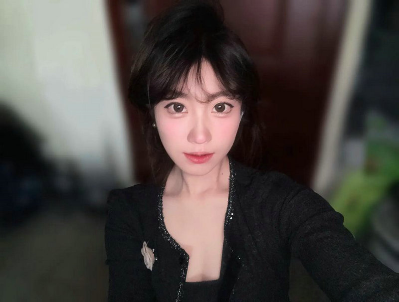 羊水过多对胎儿会造成什么影响 羊水过多对胎儿会造成什么影响