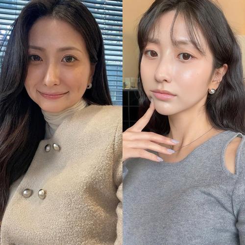 年轻人为什么会长白头发 年轻人为什么会长白头发