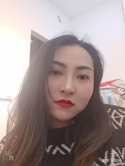 脚踝扭伤处理与康复训练 三种康复方法 脚踝扭伤处理与康复训练 三种康复方法