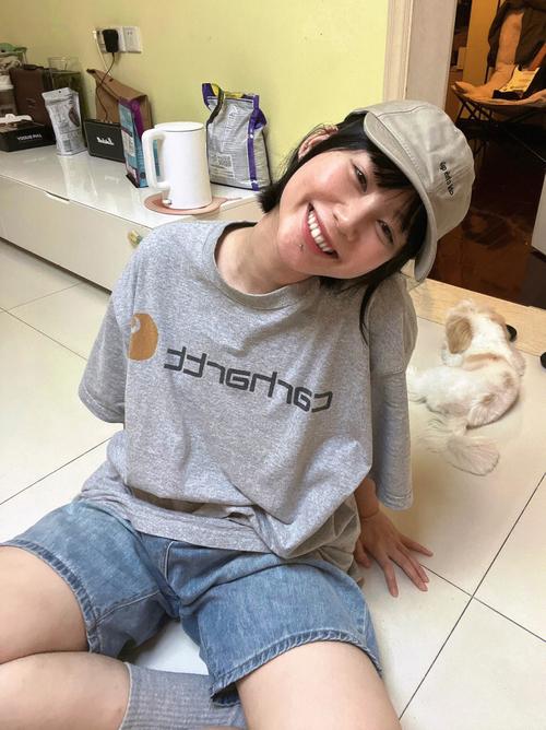 脱发药物治疗 男性治疗脱发的药物 脱发药物治疗 男性治疗脱发的药物