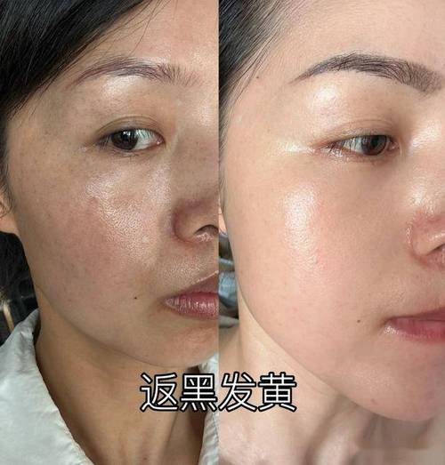 外阴痒怎么回事 外阴痒怎么回事