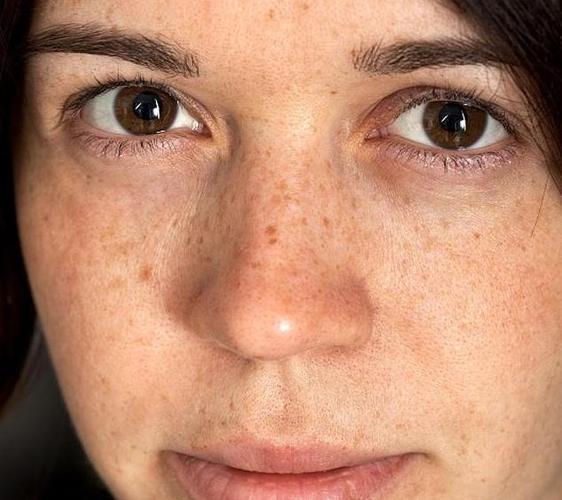 孕前检查有什么项目 孕前检查有什么项目