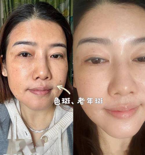 肝血管瘤是什么疾病 肝血管瘤是什么疾病